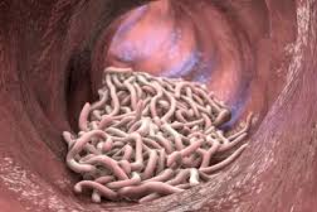 Does Ivermectin Kill Worms in Humans?