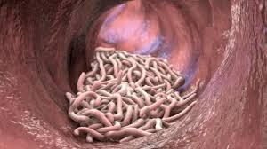 Does Ivermectin Kill Worms in Humans?