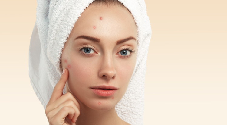 Acne Treatment in Manchester: Personalized Care for Clearer, Healthier-Looking Skin