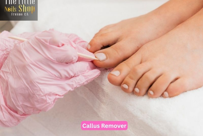 How to Choose the Best Callus Remover for Healthy Feet?