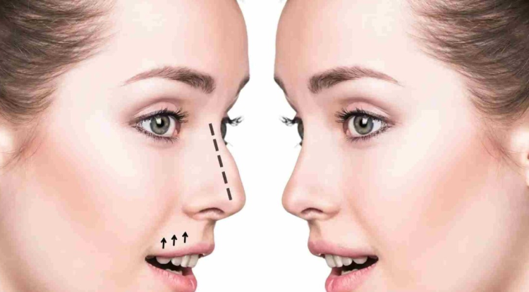 Best Rhinoplasty Surgeon in Dubai: A Complete Patient Checklist