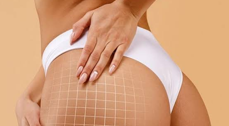 Non-surgical Butt Lift Dubai: Shape Fuller Curves Without Surgery